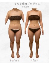 ナチュラル ビューティー スタイル さらさ(Natural Beauty Style)/さらさ痩身プログラム6カ月後