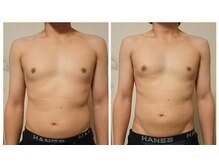 フロレゾン(Floraison)/たった１５分で腹筋復活？
