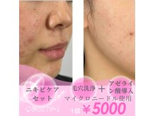 スムース イー(Smooth+E)の雰囲気（高槻で本気の毛穴　ニキビケア　年齢肌改善なら当店へ。）