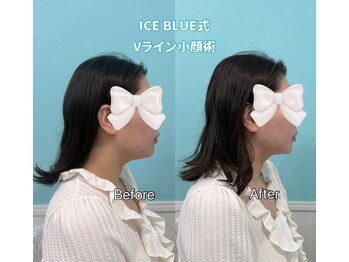 ビーナスアイスブルー(Venus ICE BLUE)の写真/小顔も美肌もすぐに手に入るサロン