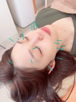 ヒーリングサロン アージュ(A-je)/★美顔鍼＋小顔矯正★