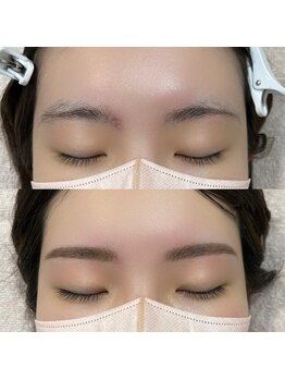 アディクト 恵比寿店(ADDICT)/アイブロウ/眉毛