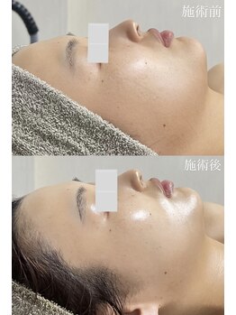 クレヴィー(Creviy)/最先端の最強細胞美容コース