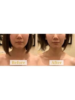 アジール 新潟市(agir)/Before/After画像