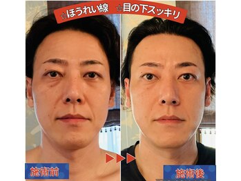 ウルワシ(Uruwashi)/★ビフォーアフター★