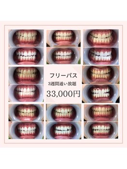 ルブラン 奈良店(Le Blanc)/初めての方にもオススメの