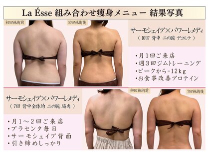 ラエッセ(La Esse)の写真