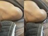 【巻肩特化】極楽コース(ボディケア×リンパセット）足湯＋ドリンク付