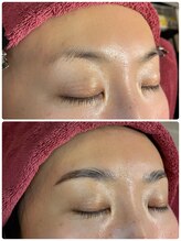 アールラッシュ(R-LASH)/