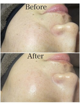 ブラックボックス(BLACK BOX)/30代女性のお客様