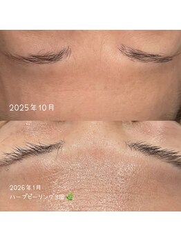 カイト(Kaito)/ハーブリプロ