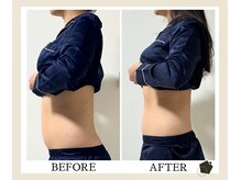 サンク(Cinq)の雰囲気（美容家に大人気◆腸もみダイエット/リンパマッサージ/痩身/冷え）