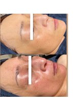 ビエン(美艶 b.en)/TIP集中プログラム