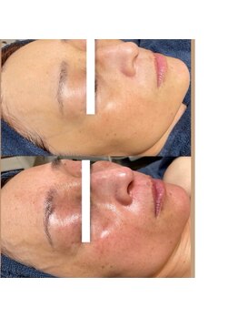 ビエン(美艶 b.en)/TIP集中プログラム