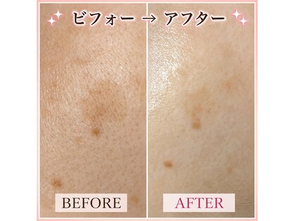 ココスタイルビューティー(COCOSTYLE beauty)の写真
