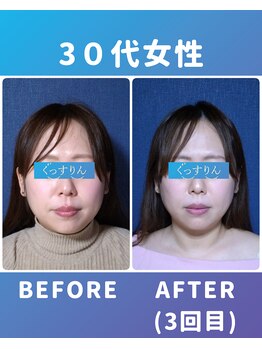 ぐっすりん/複数回継続のお客様の変化(8)