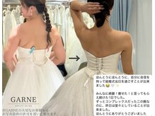 ガーネ(GARNE)の雰囲気(ビフォーアフター写真&ブログ掲載中!【小顔×痩身/ブライダル】)