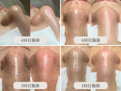 トネア 自由が丘店の写真