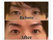 整体ラルース 中目黒(LALUZ)/30代　男性　二重整体　変化