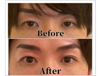 整体ラルース 中目黒(LALUZ)/30代 男性 二重整体 変化