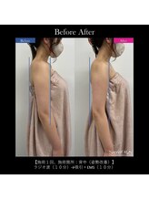 グラシアス/グラシアス | 症例写真