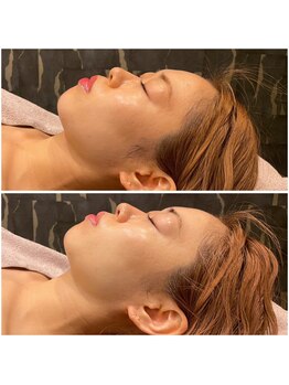 ビュウナ 銀座(BEAUNA)/ブライダル☆セレクトbody