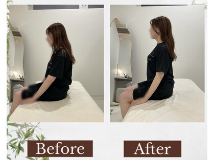 ルノア 梅田院(LUNOA)の写真