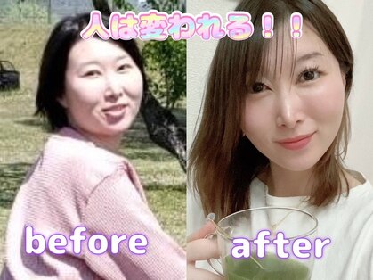 ヨサパーク ポミエ(YOSA PARK Pommier)の写真