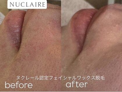 プラージュ(plage)の写真