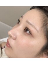 アンバーレス 新栄(AmberRes)&nbsp;まつげ パーマ
