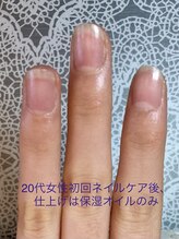 桃の木 吉祥寺店/20代女性初回施術後