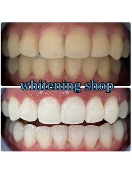 ホワイトニングショップ 和歌山店/圧倒的美白セルフホワイトニング