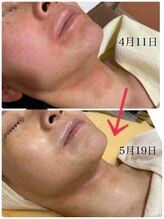 ユウ 尾張旭店(U)/エンビロンスペシャルケア