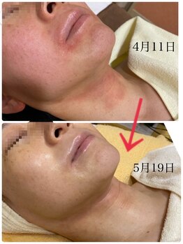 ユウ 尾張旭店(U)/エンビロンスペシャルケア