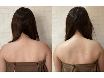 サロンドミジュ(Salon de 美jyu)/骨格小顔矯正×猫背矯正