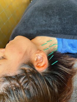 メディカルジャパン 吉祥寺/つらい首のこりや痛みも軽減