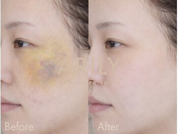 アリリィ(ARILY)/ARILY after care salon