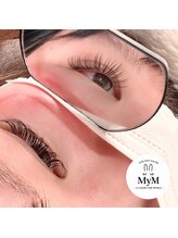 マイム(MyM)/施術例