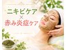 【繰り返すニキビに終止符を】ハーブピーリング×導入×鎮静海藻パック