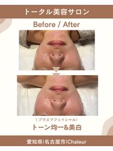 シャルール プラス(Chaleur+)/