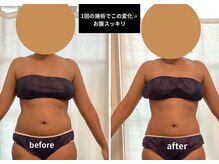 ケイ(K)の雰囲気（背中・お腹ハイパーナイフ+ボディーケアでお腹周りスッキリ！）