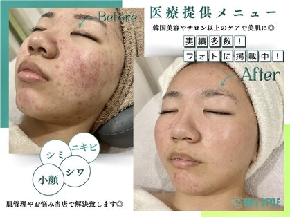 ベルスタイル(Bell style)の写真