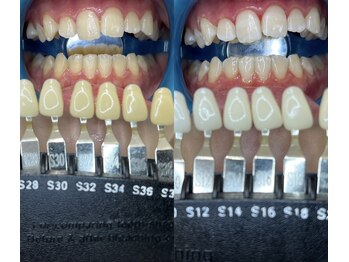 トウキョウスワーズ 池袋店(TOKYO SWRS)/#ホワイトニング #池袋 #渋谷