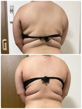 ルーメ(lume)/20代女性