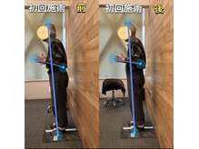 アスモ(ASUMO)の雰囲気（原因を正すので、姿勢改善効果も）