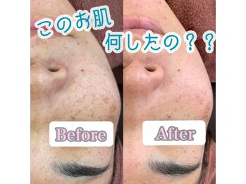 ラエッセ(LAESSE)/さまざまなお悩みを解決☆彡