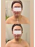 《輪郭のモタつきが気になったら》リフトアップフェイシャル 5,000円60分