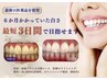 【最速プラン36,300円】医療提携ホワイトニング3日間完結コース