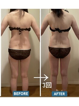 ヨサパーク レナータ(YOSA PARK Renata)/luluonnの基本は初回から連続3回