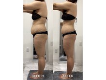 ナルシス/【痩身】5ヶ月の変化です★